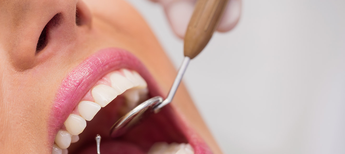 Dentes brancos – Higiene Oral