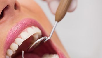 Dentes brancos – Higiene Oral